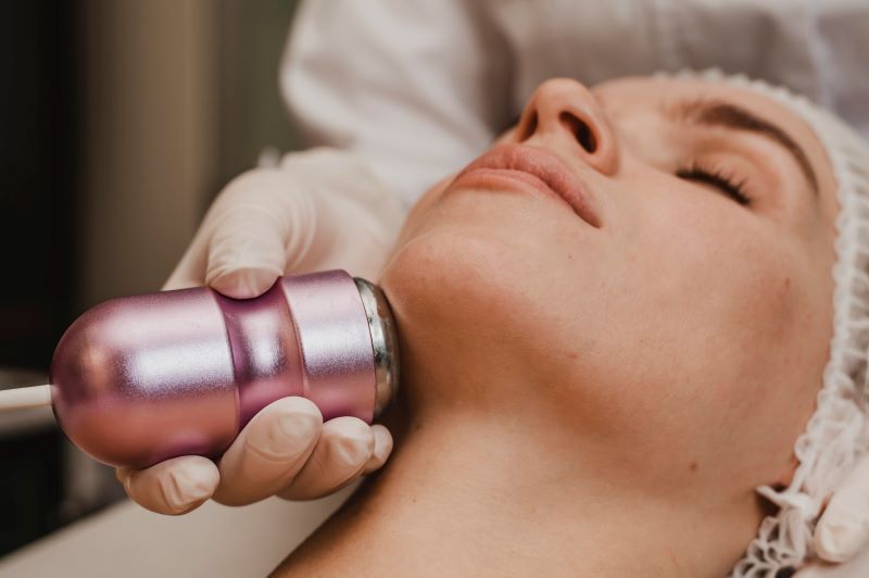 Radiofrequency Lifting
